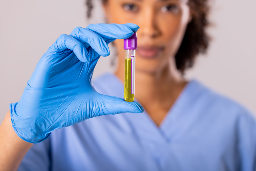 a nurse holding a liquid biopsy breast cancer sample in a sealed vial - biomark diagnostics